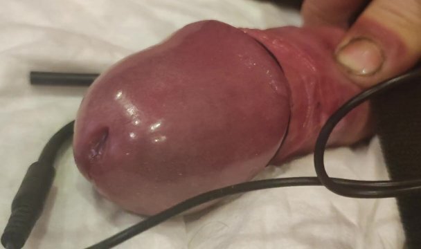 Стимуляция члена E-STYM