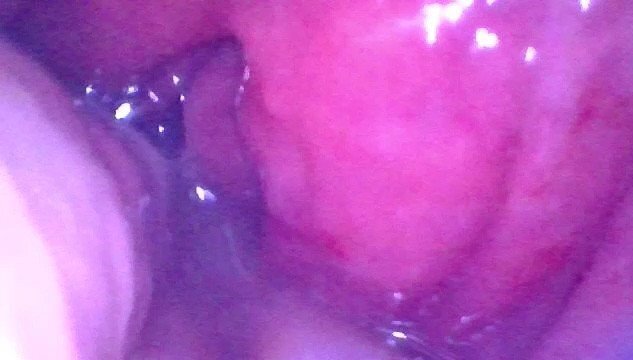 Endope inside juicy getting fisted deeply Preview