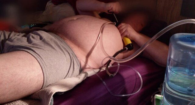 Gallons Belly Inflation