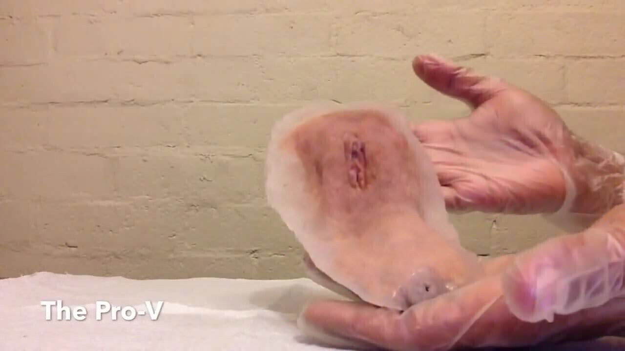 Prosthetic for Trans Women