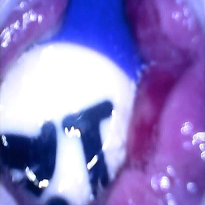 Pool balls inside my ass