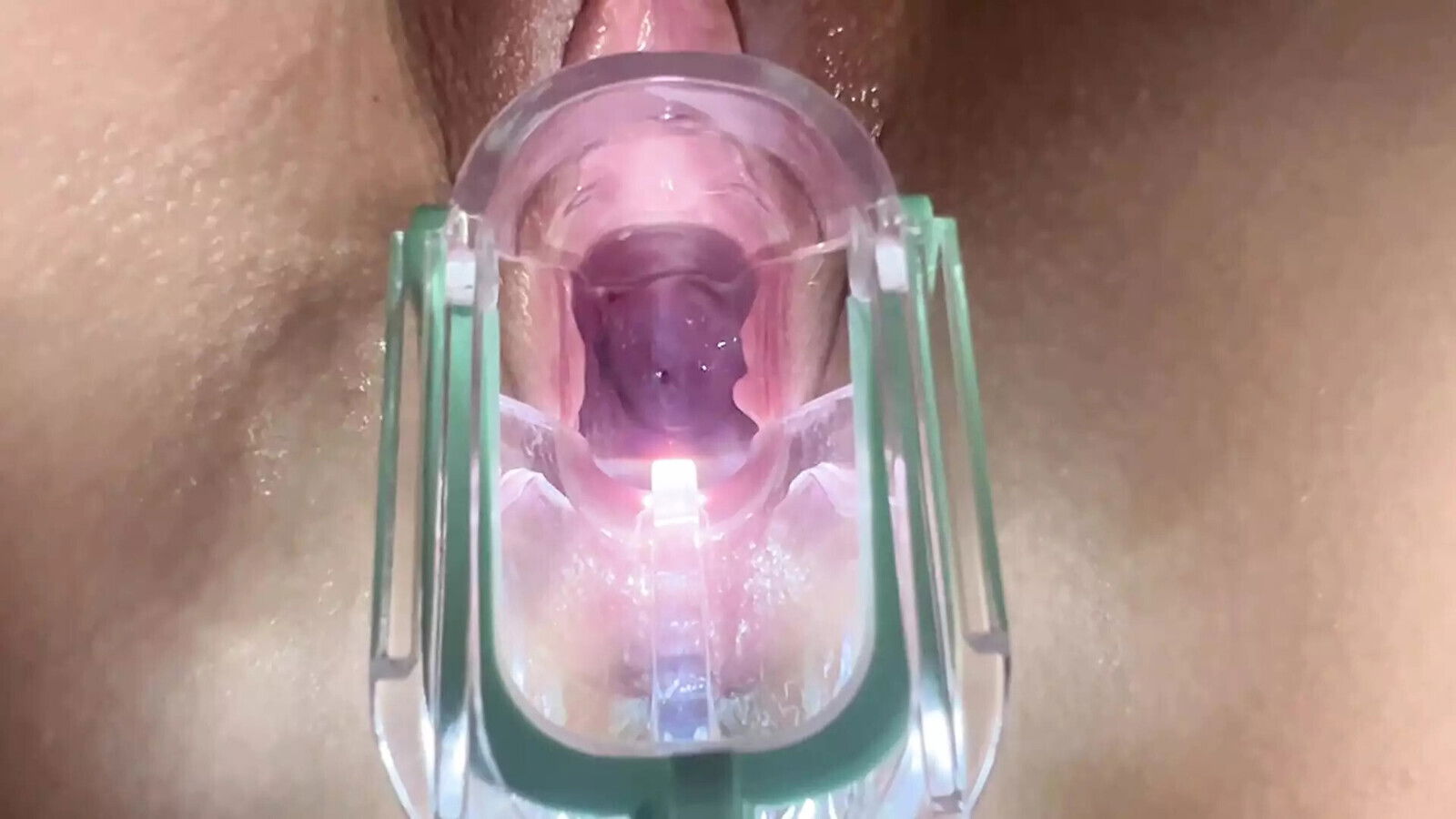 Stella Rose Extreme Gaping, Cervix Close-Up using Speculum