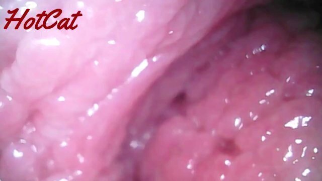 Endoscopic ♥vaginal observation内視鏡おまんこ♥膣内観察
