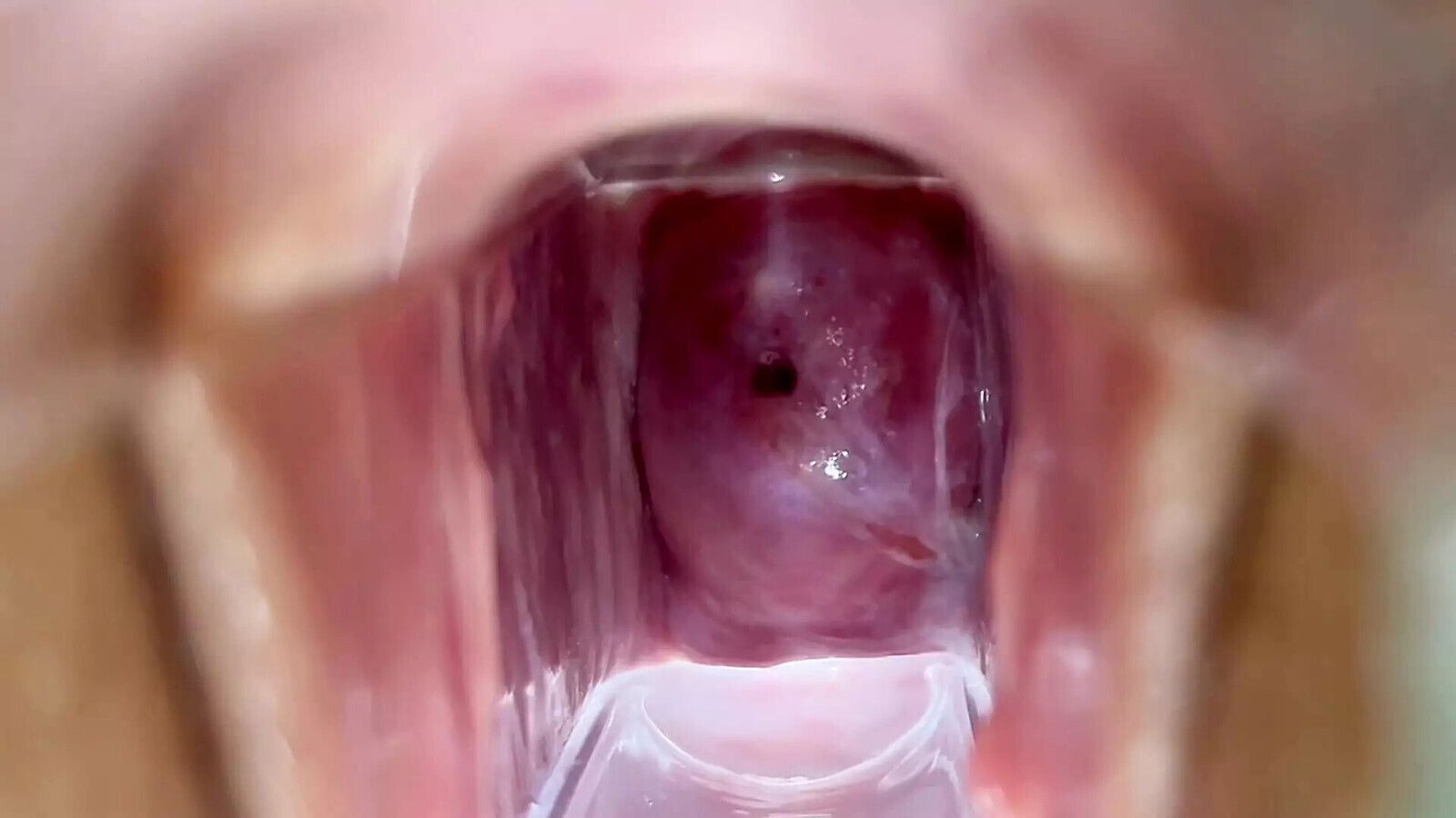 Stella Rose Extreme Cervix Views Juices Flowing Using Speculum