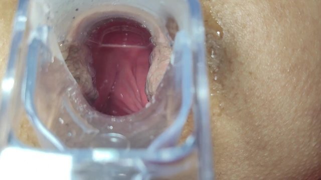 position fours speculum