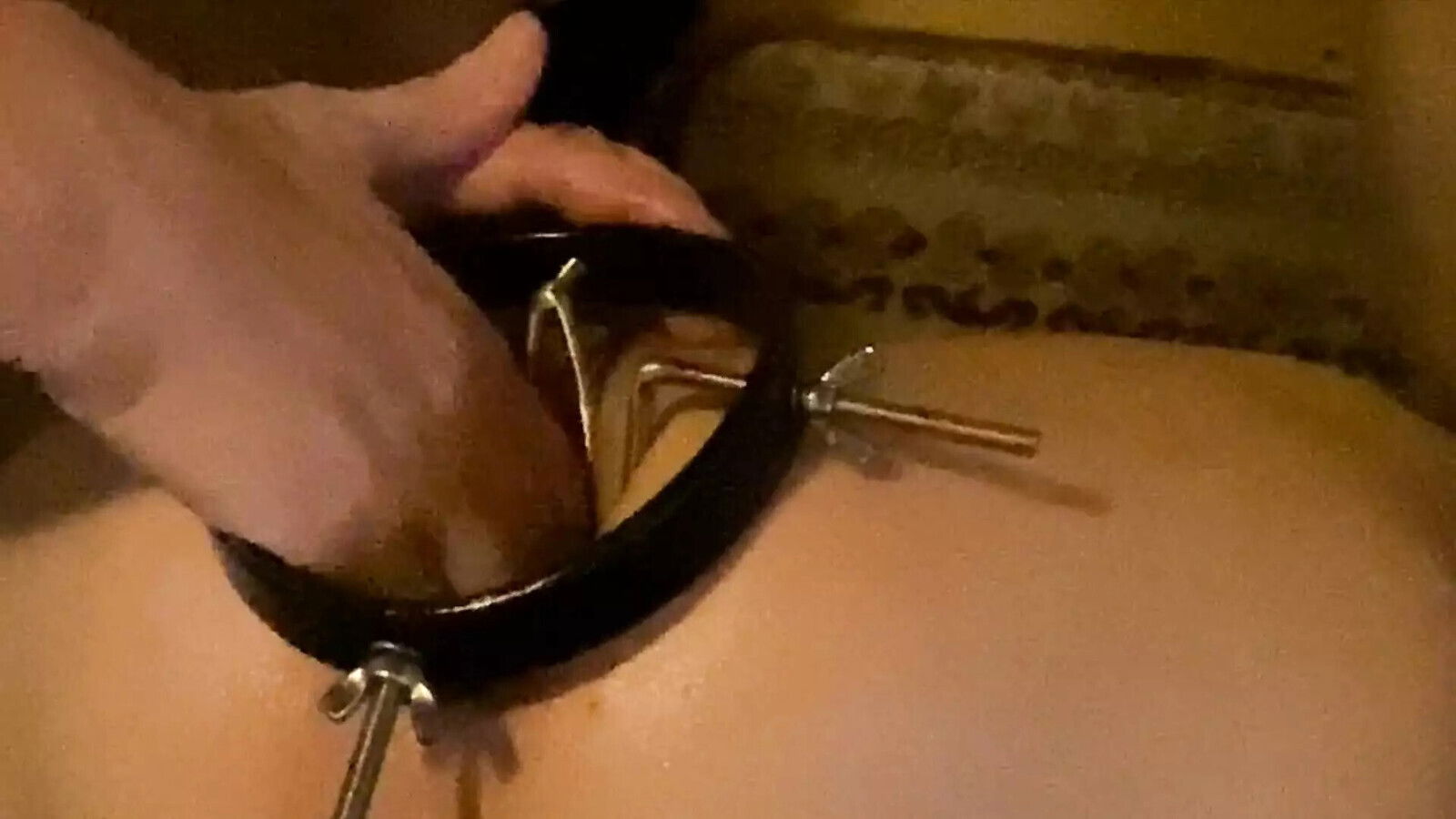 Asshole Treatment Part