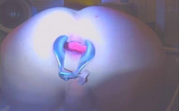 EXTREME!!! butthole stretched open while intestines moan!!!! speculum!!!!