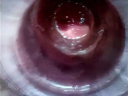 black hole pink hole?