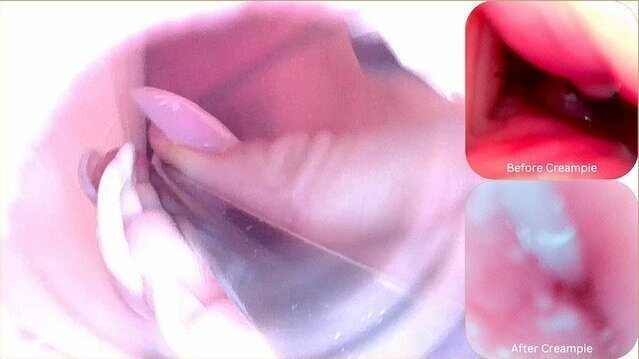 Camera Inside Pussy Before After Creampie Cervix