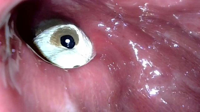 Meerkat sinking deep into descending colon