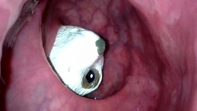 Meerkat getting sucked into descending