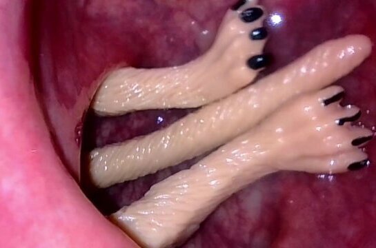 Meerkat slips into sigmoid headfirst