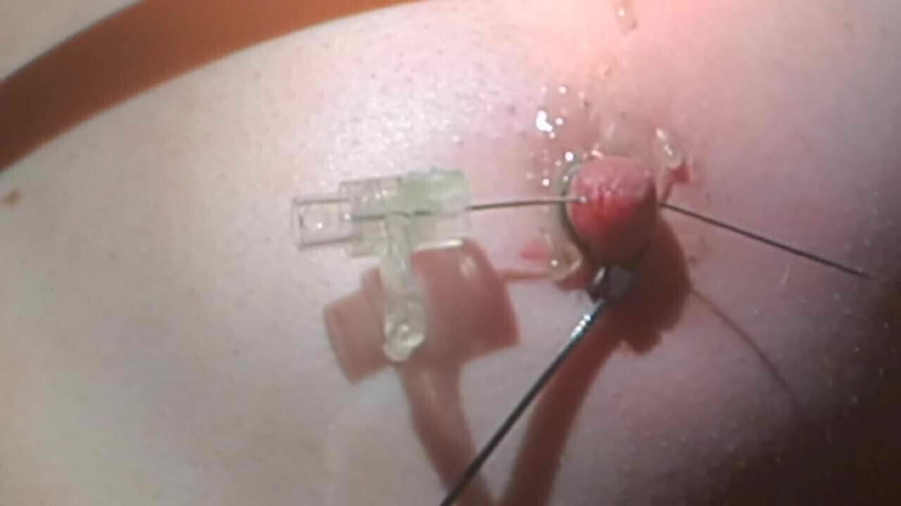 Niples torture extreme 2
