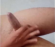 Novinho exibindo fimose