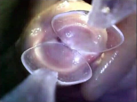 endoscope in 2 spoons push inside urethra cock exploration