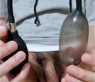 Korslaveman Sounding with pumping used widen urethra