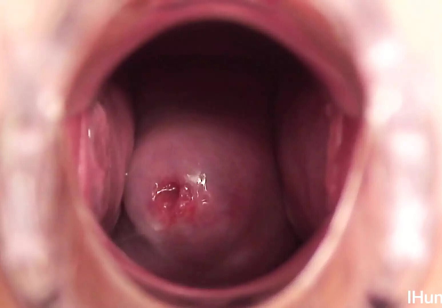 Young nurse gapes pussy shows cervix through speculum